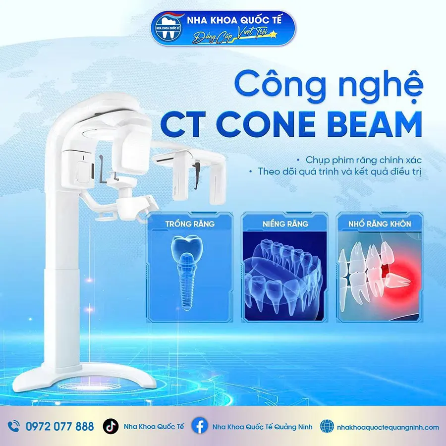 CT Cone Beam