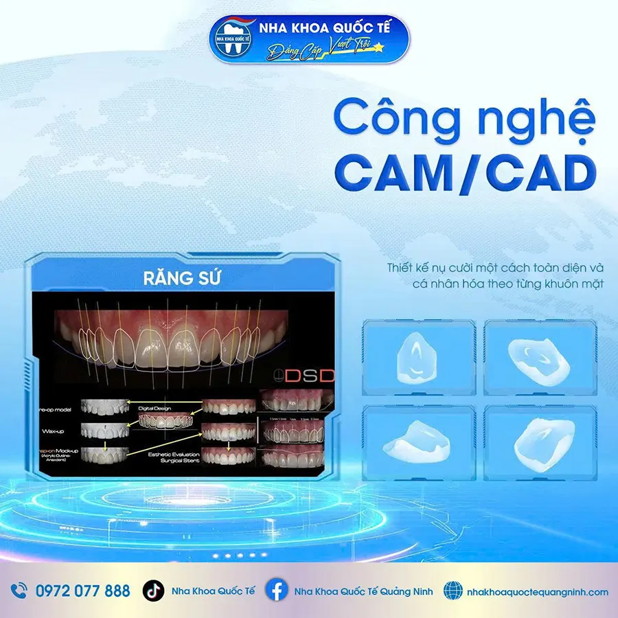 Công nghệ CAM CAD
