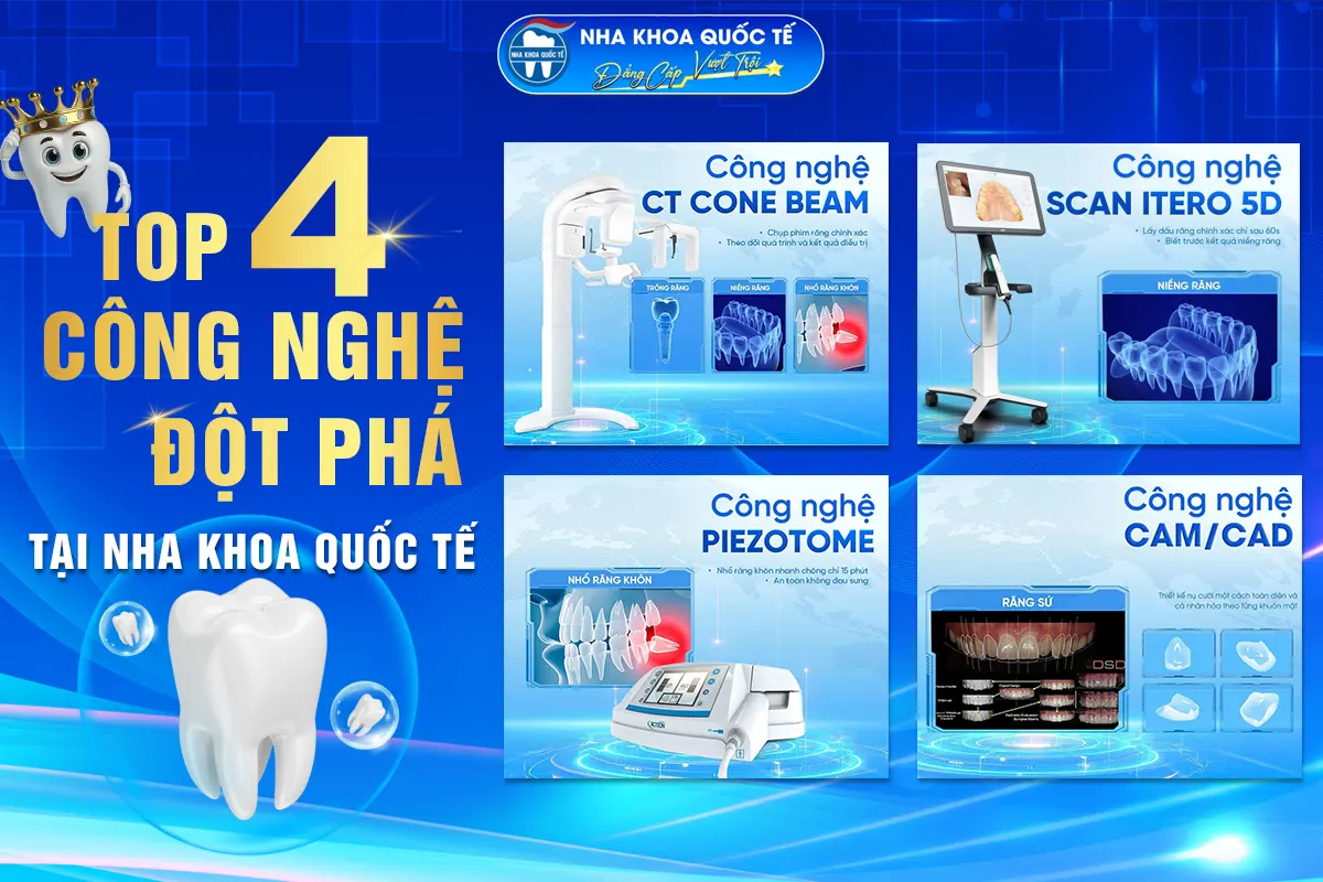 Top 4 công nghệ nha khoa