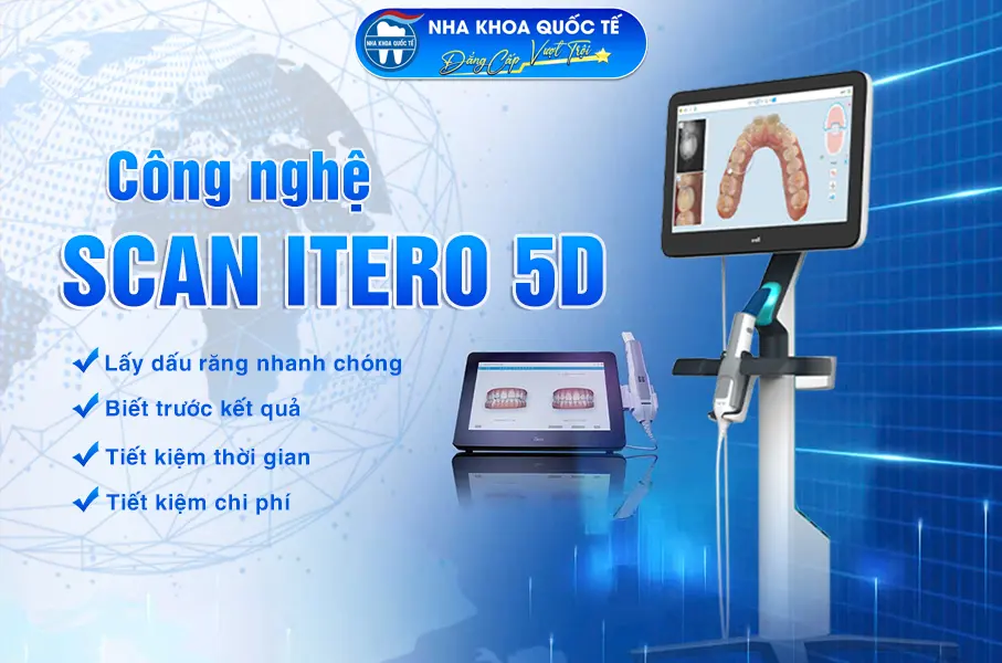 Công nghệ Scan itero 5d