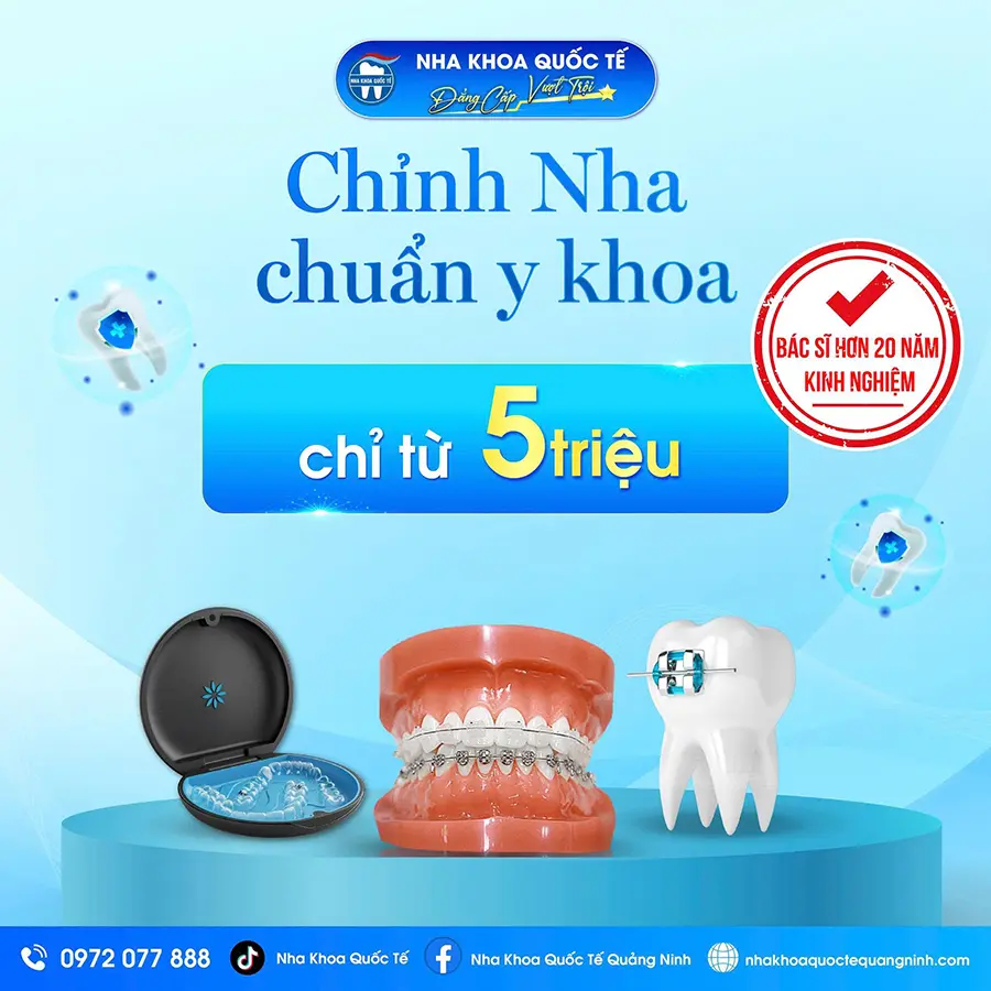 Chỉnh nha thẩm mỹ