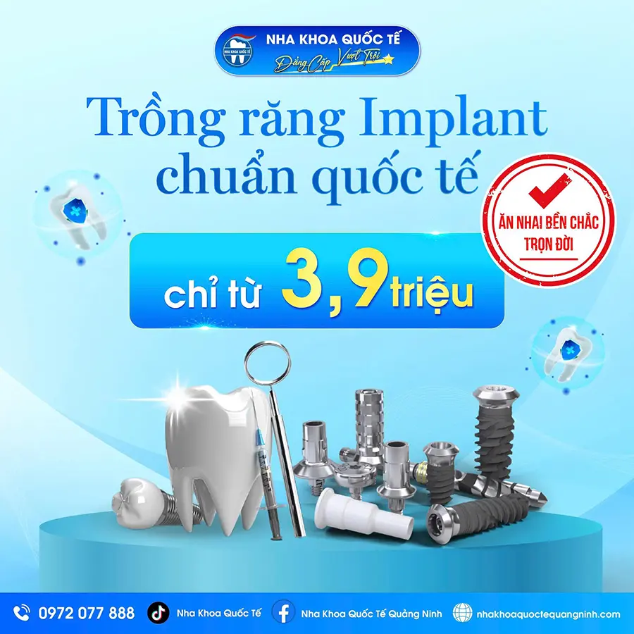 Khuyến mãi trồng implant