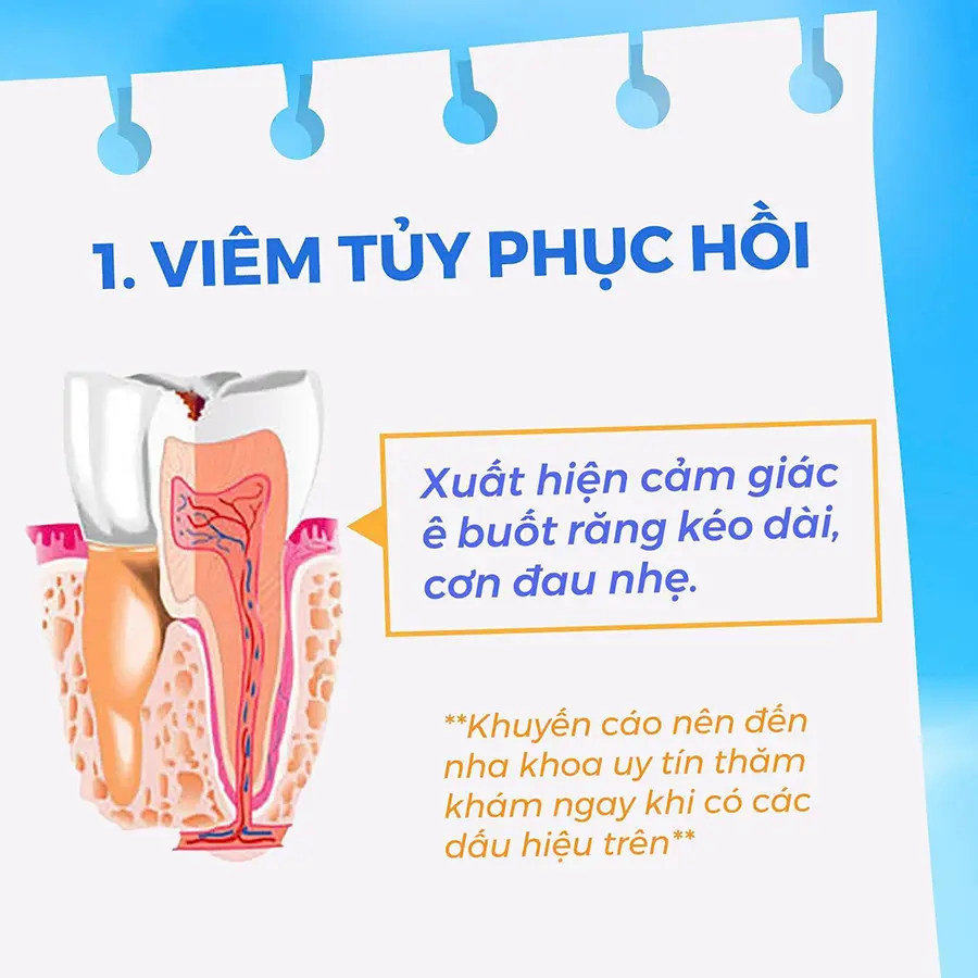 viêm tủy hồi phục
