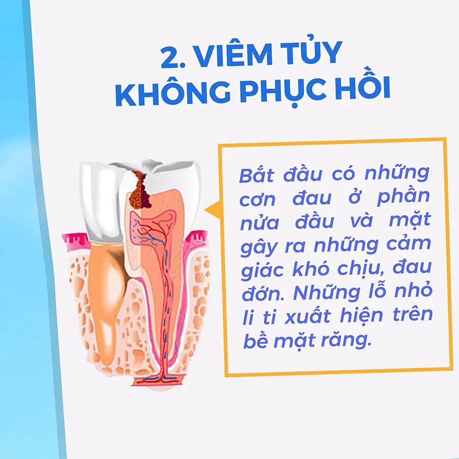 viêm tủy không phục hồi