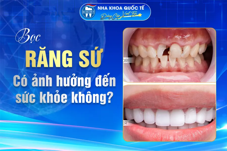 bọc răng sứ có ảnh hưởng sk không