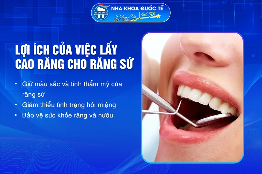 lợi ích lấy cao răng