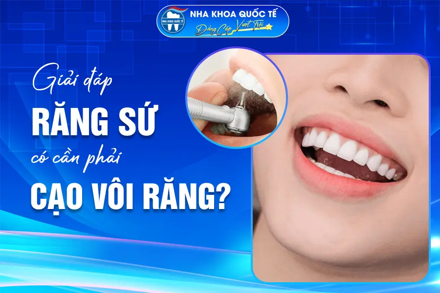 răng sứ có cần cạo vôi răng