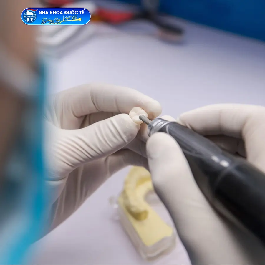 chế tạo răng sứ tại nha khoa quốc tế