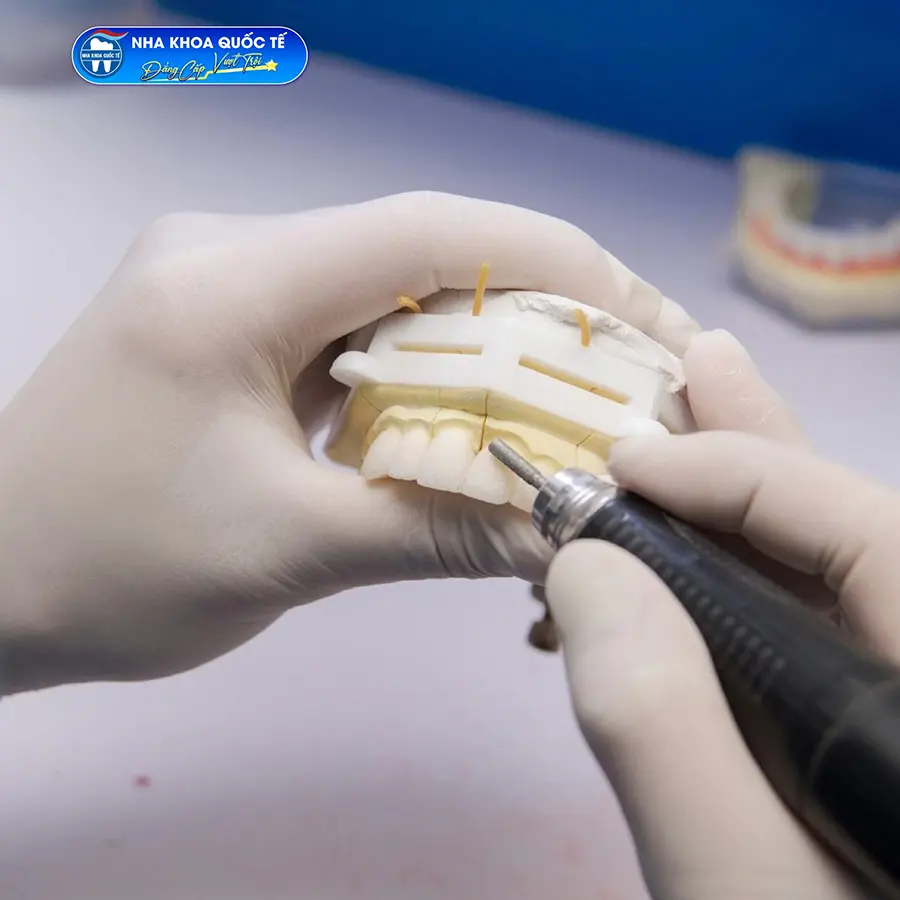 chế tạo răng sứ tại nha khoa