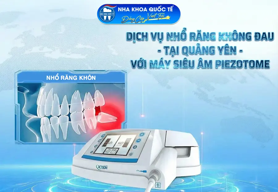 Dịch vụ nhổ răng tại quảng yên 2