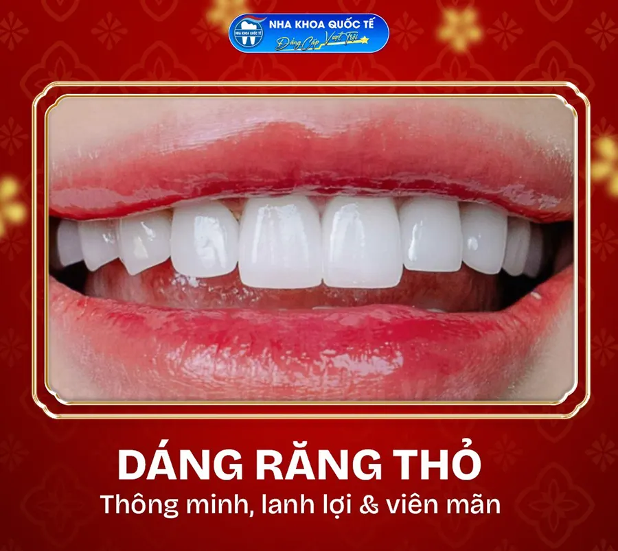 Dáng răng Thỏ