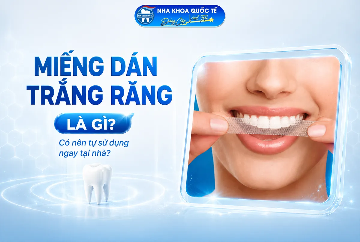 Miếng dán trắng răng là gì