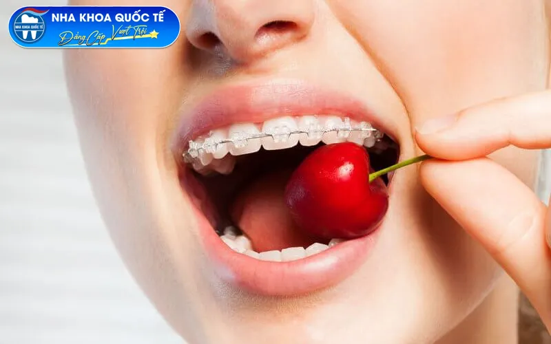 ăn uống khó hơn khi niềng