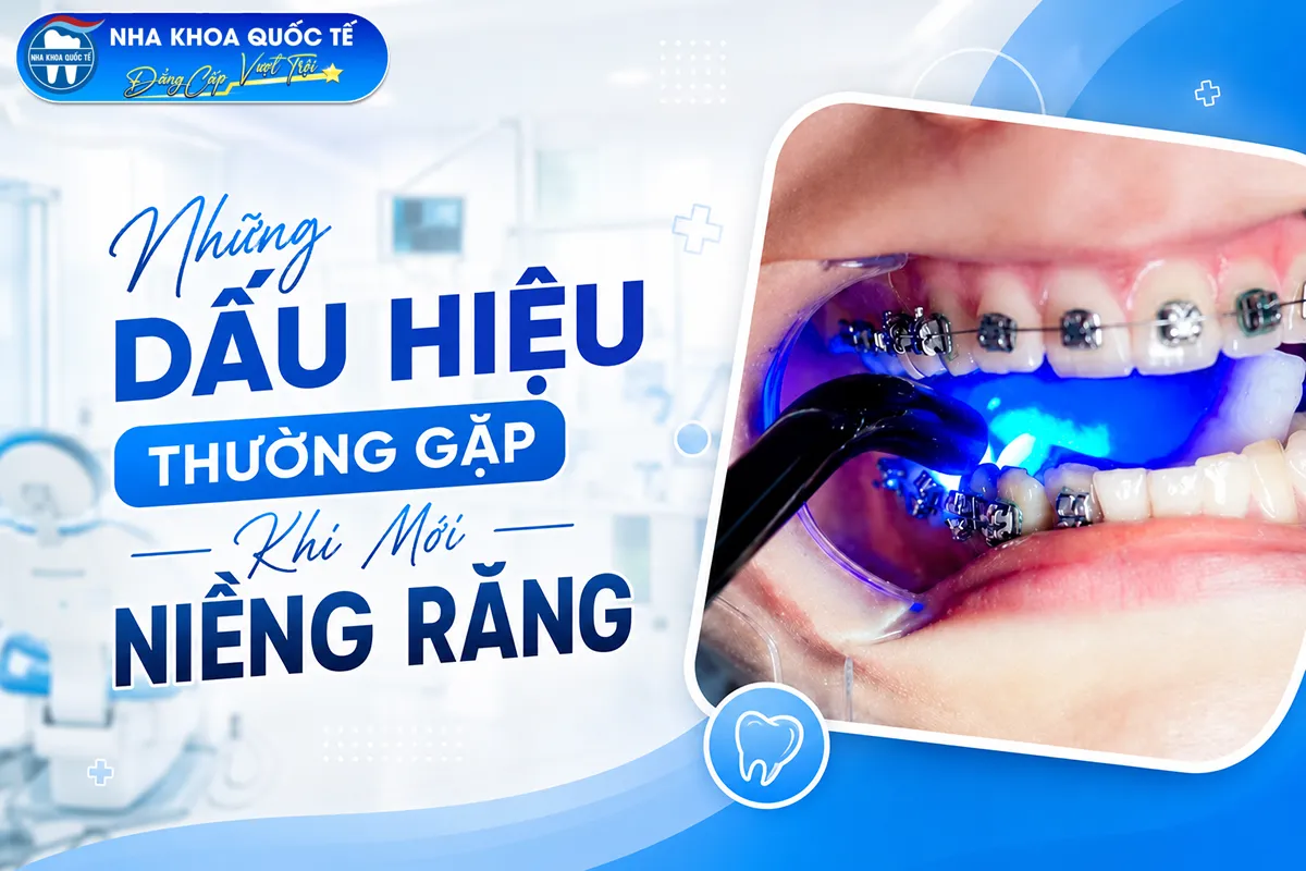những dấu hiệu thường gặp khi mới niềng