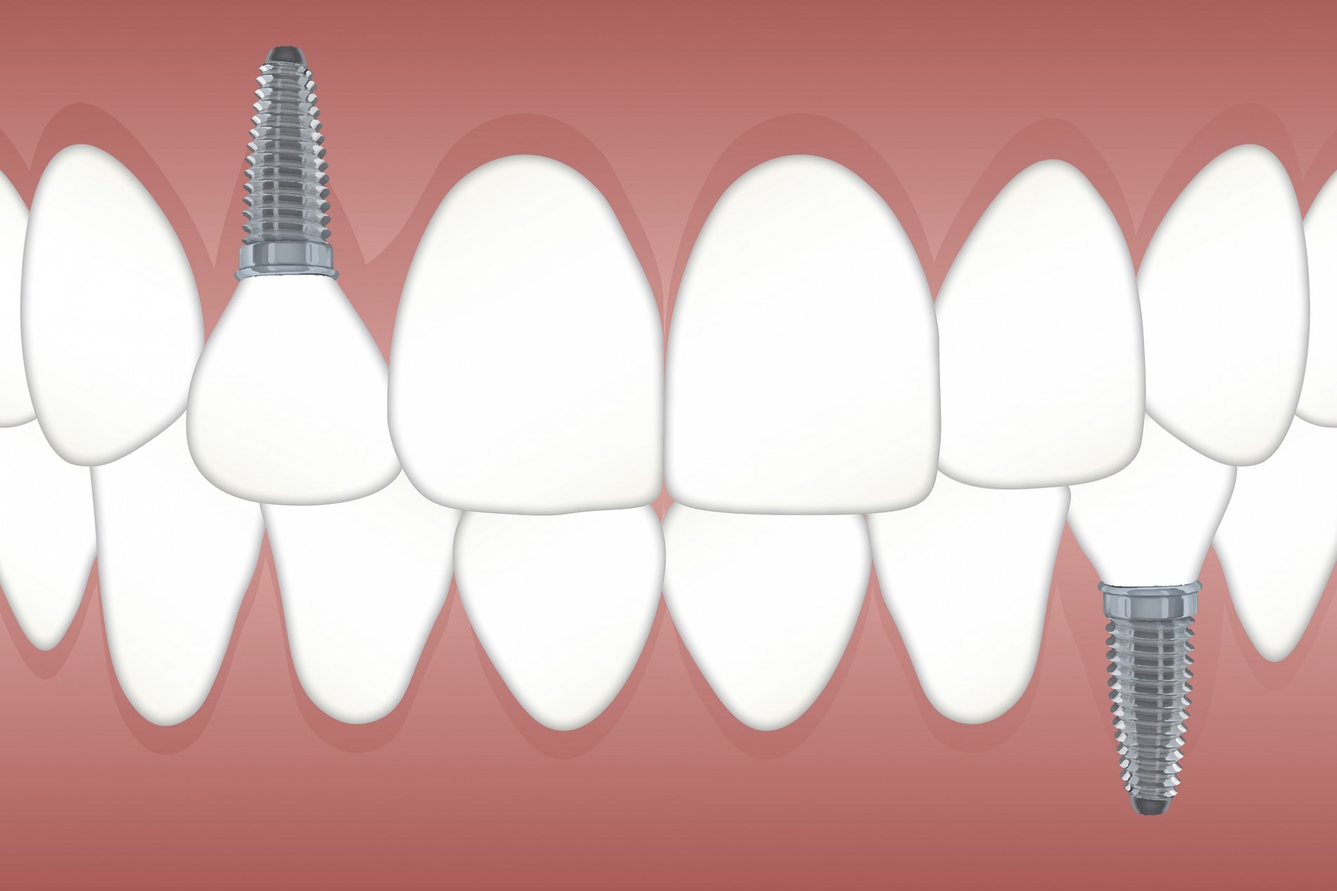 teeth-3597679_1920