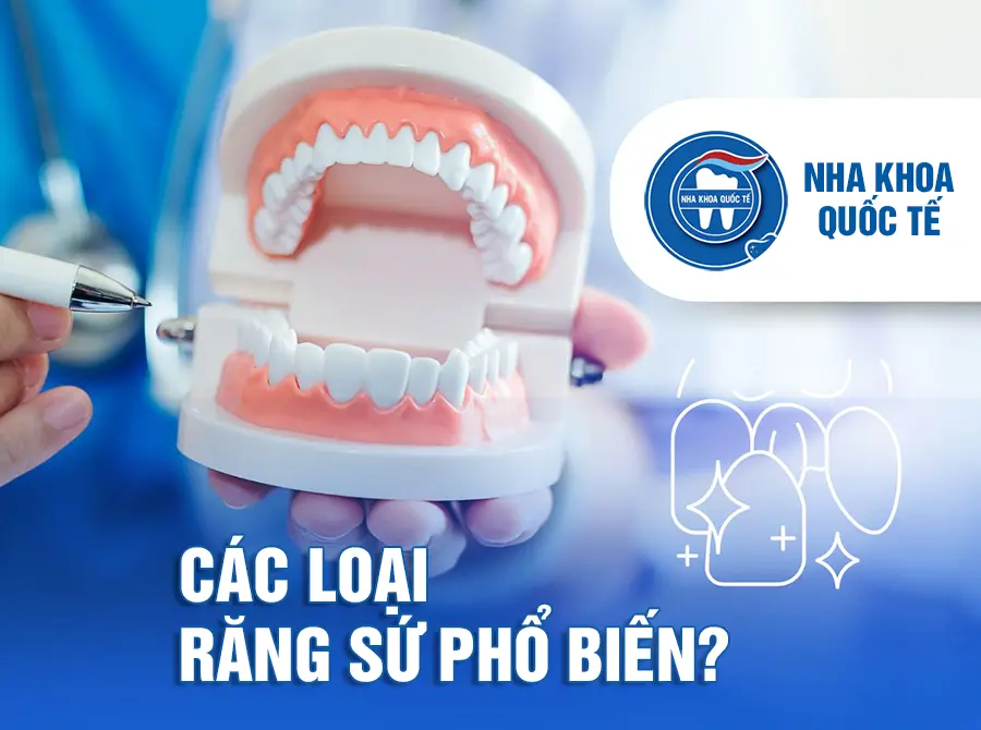 Các loại răng sứ phổ biến