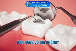 Hàn răng có hại không?