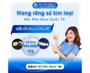 Khuyến mãi đổi răng toàn sứ