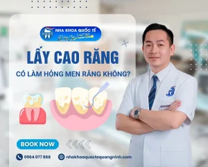 Lấy cao răng có làm hỏng men ko