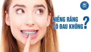 Niềng răng có đau không