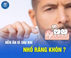 Nên ăn gì sau nhổ răng khôn