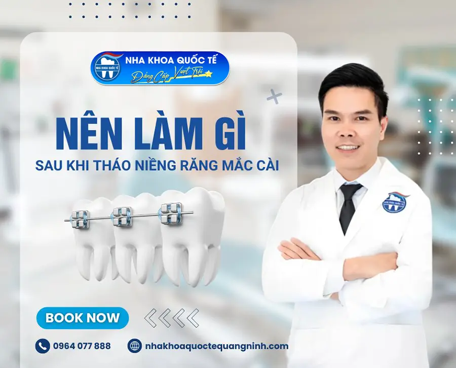 Lời khuyên bác sĩ sau tháo niềng răng