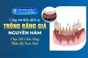 Trồng răng nguyên hàm