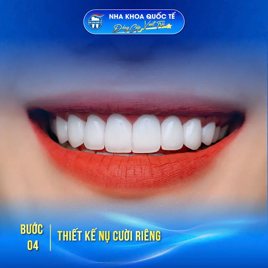 Bước 4 bọc răng sứ