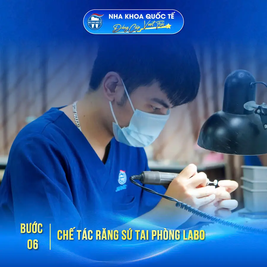 Bước 6 bọc răng sứ