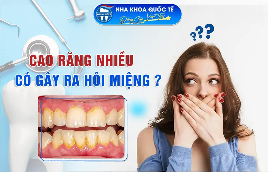 Cao răng nhiều có gây hôi miệng?