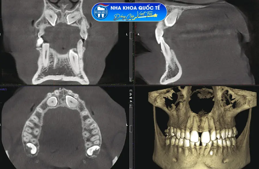 ct cone beam 3d