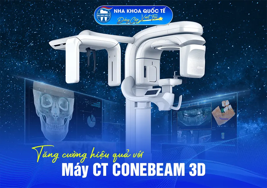 máy ct cone beam 3d