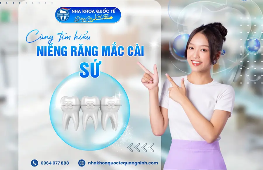 Niềng răng mắc cài sứ