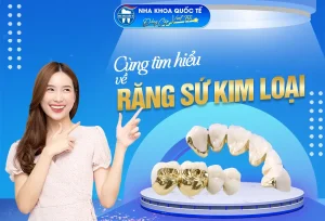 Răng sứ kim loại là gì?