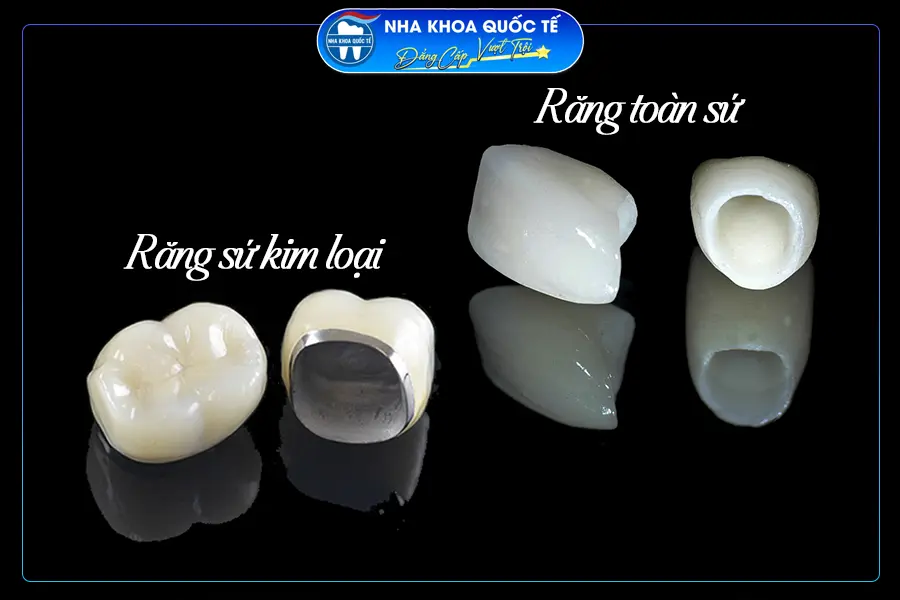 So sánh răng sứ kim loại thường và răng toàn sứ