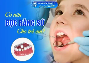 Bọc răng sứ cho trẻ