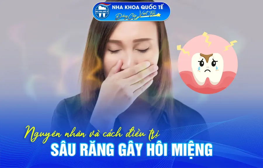 Sâu răng gây hôi miệng