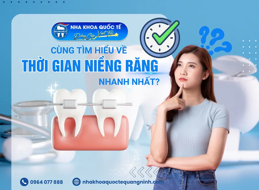 Thời gian niềng răng