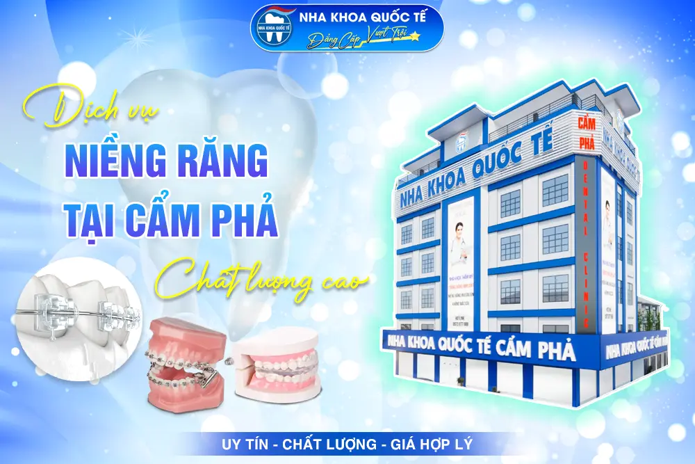 Niềng răng tại Cẩm Phả
