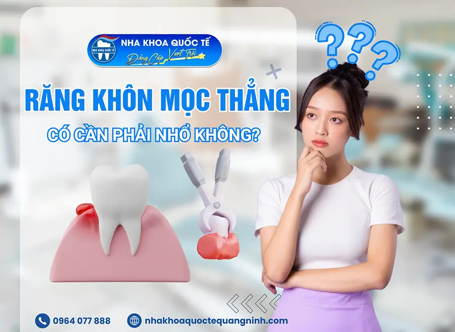 Có nên nhổ răng khôn mọc thẳng