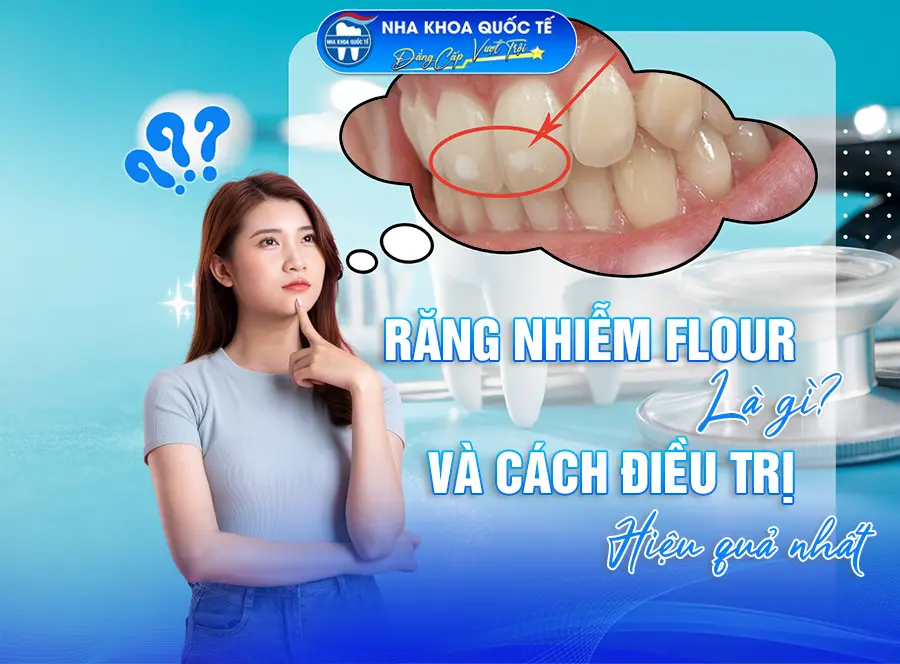 Răng Nhiễm Fluor và điều trị