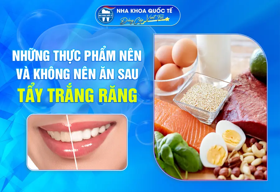 Sau khi tẩy trắng răng