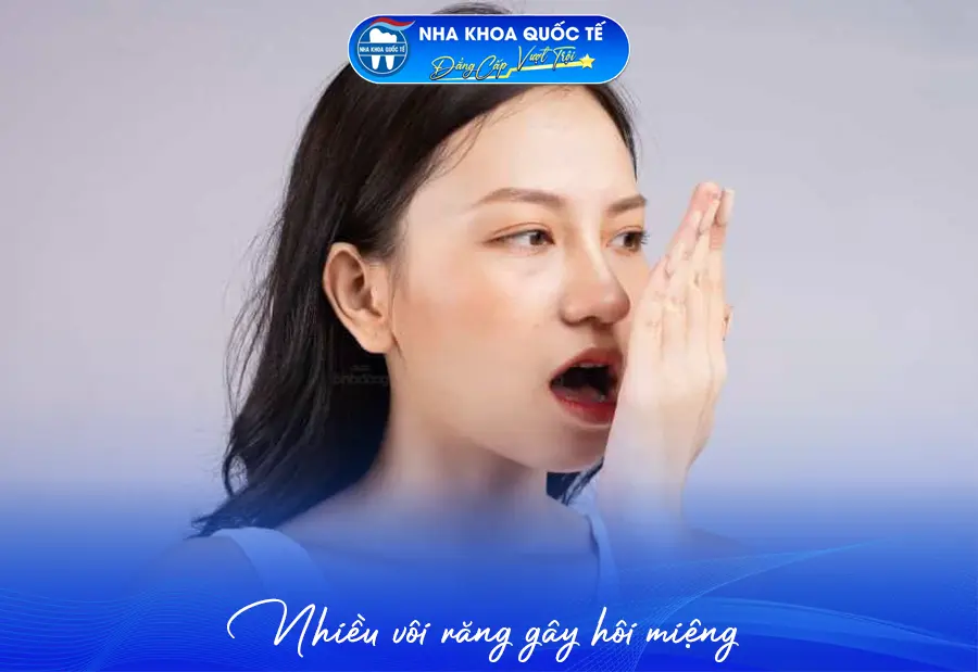 Vôi răng gây hôi miệng