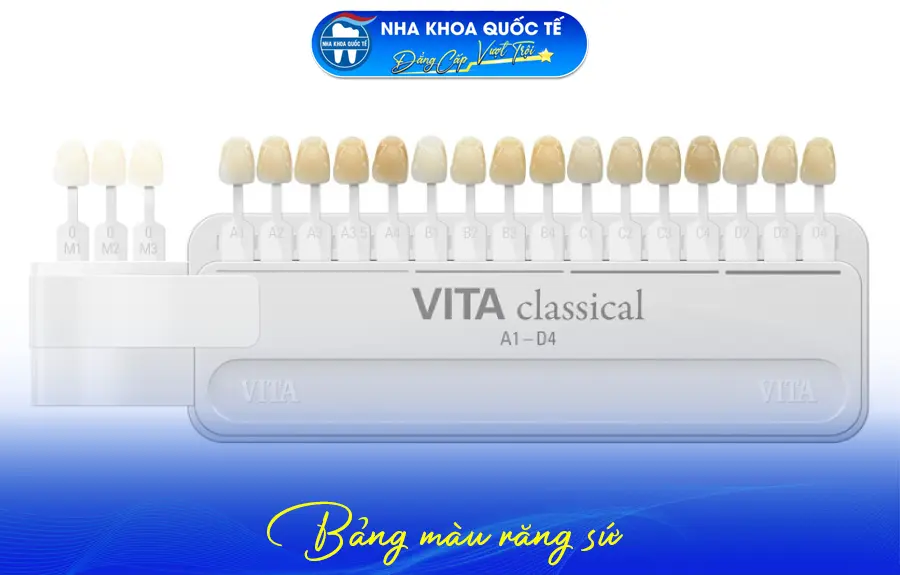 Bảng màu răng sứ