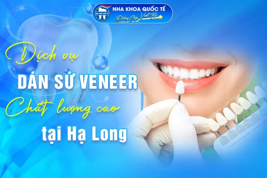 dán sứ Veneer tại Nha khoa Hạ Long