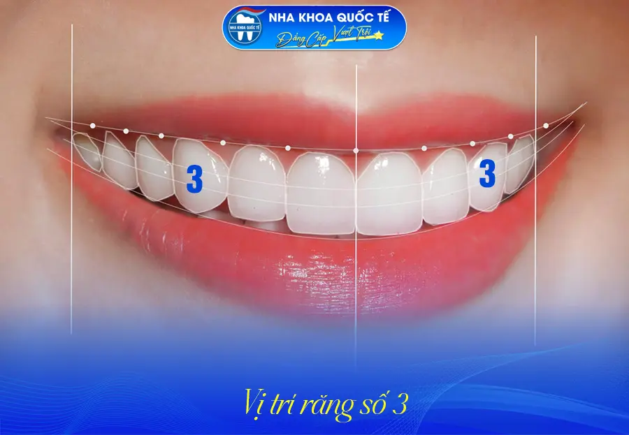 Răng số 3