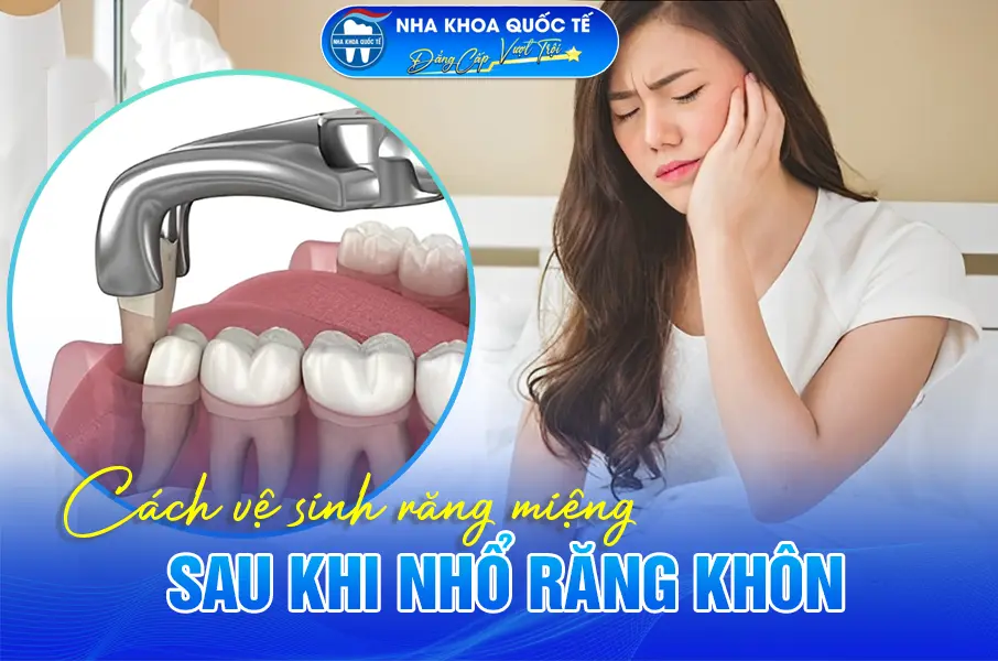 Vệ sinh răng miệng sau khi nhổ răng khôn