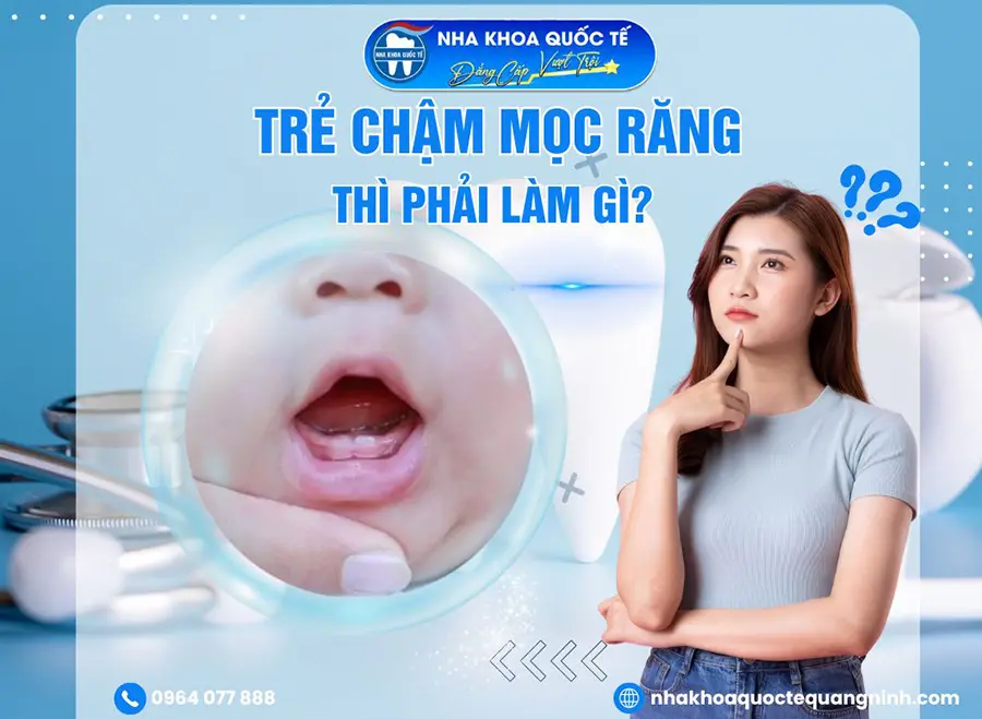 Trẻ chậm mọc răng