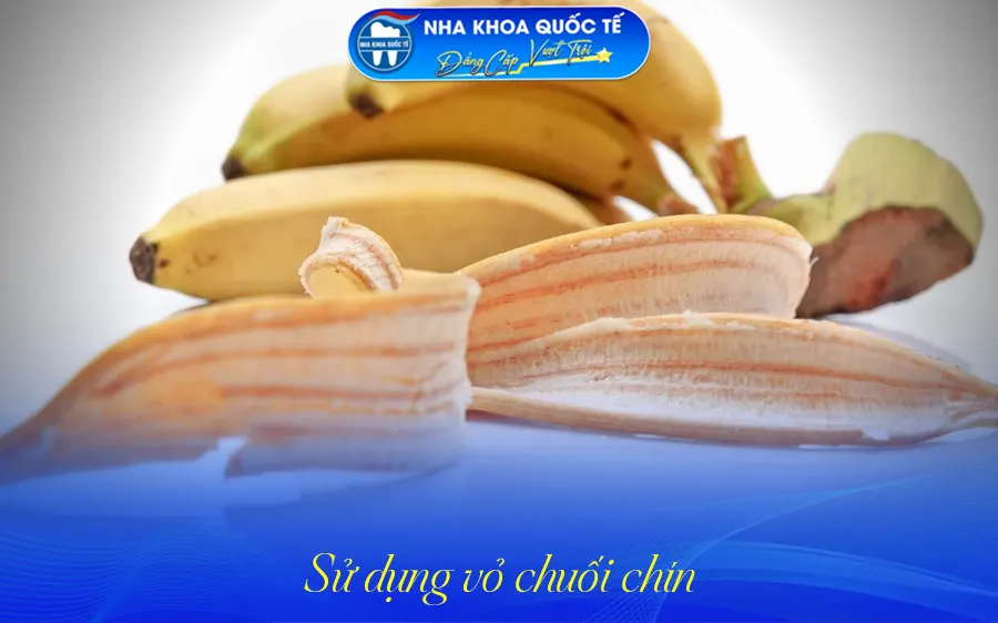 Vỏ chuối chín làm trắng răng