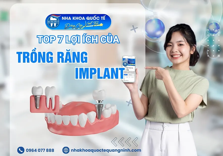 lợi ích của Trồng răng Implant